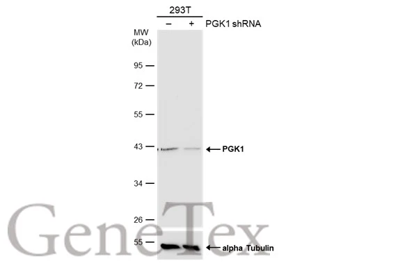 Non-transfected (–) and transfected (+) 293T whole cell extracts (30 μg) were separated by 10% SDS-PAGE, and the membrane was blotted with PGK1 antibody [N1C1] (GTX101405) diluted at 1:1000. The HRP-conjugated anti-rabbit IgG antibody (GTX213110-01) was used to detect the primary antibody.