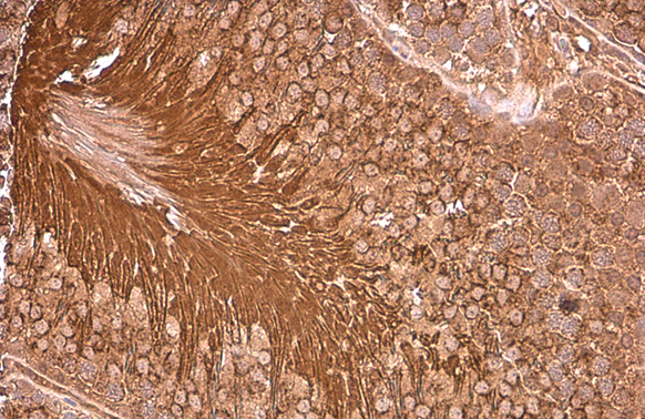 PGK1 antibody [N1C1] detects PGK1 protein at cytoplasm by immunohistochemical analysis. Sample: Paraffin-embedded rat testis. PGK1 stained by PGK1 antibody [N1C1] (GTX101405) diluted at 1:500. Antigen Retrieval: Citrate buffer, pH 6.0, 15 min