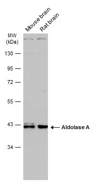 Various tissue extracts (50 μg) were separated by 10% SDS-PAGE, and the membrane was blotted with Aldolase A antibody (GTX101408) diluted at 1:1000. The HRP-conjugated anti-rabbit IgG antibody (GTX213110-01) was used to detect the primary antibody.