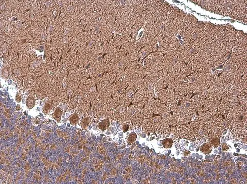 ABAT antibody detects ABAT protein at cytoplasm in mouse brain by immunohistochemical analysis. Sample: Paraffin-embedded mouse brain. ABAT antibody (GTX101413) diluted at 1:500. 
 Antigen Retrieval: Trilogy? (EDTA based, pH 8.0) buffer, 15min