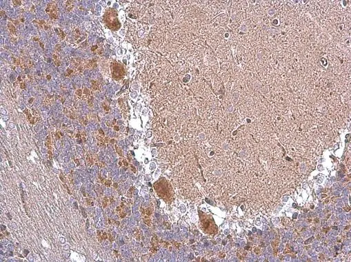 ABAT antibody detects ABAT protein at cytoplasm in rat brain by immunohistochemical analysis. Sample: Paraffin-embedded rat brain. ABAT antibody (GTX101413) diluted at 1:500. 
 Antigen Retrieval: Trilogy? (EDTA based, pH 8.0) buffer, 15min