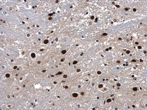 p54/nrb antibody detects p54/nrb protein at nucleus in mouse brain by immunohistochemical analysis. Sample: Paraffin-embedded mouse brain. p54/nrb antibody (GTX101419) diluted at 1:500. 
 Antigen Retrieval: Citrate buffer, pH 6.0, 15 min