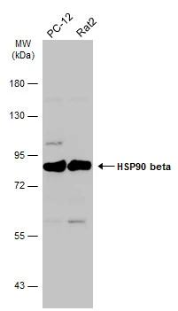 Various whole cell extracts (30 μg) were separated by 7.5% SDS-PAGE, and the membrane was blotted with HSP90 beta antibody [N2C2], Internal (GTX101423) diluted at 1:2000. The HRP-conjugated anti-rabbit IgG antibody (GTX213110-01) was used to detect the primary antibody.