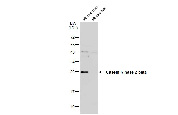 Various tissue extracts (50 μg) were separated by 12% SDS-PAGE, and the membrane was blotted with Casein Kinase 2 beta antibody (GTX101439) diluted at 1:500. The HRP-conjugated anti-rabbit IgG antibody (GTX213110-01) was used to detect the primary antibody, and the signal was developed with Trident ECL plus-Enhanced.