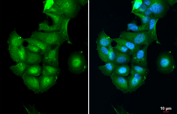 Casein Kinase 2 beta antibody detects Casein Kinase 2 beta protein at cytoplasm and nucleus by immunofluorescent analysis. Sample: MCF-7 cells were fixed in 4% paraformaldehyde at RT for 15 min. Green: Casein Kinase 2 beta stained by Casein Kinase 2 beta antibody (GTX101439) diluted at 1:500.