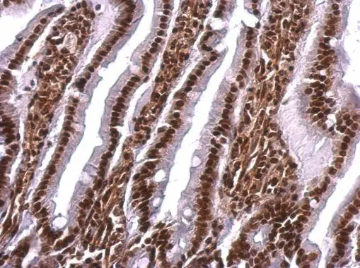 Scaffold attachment factor B1 antibody detects Scaffold attachment factor B1 protein at nucleus on rat fore brain by immunohistochemical analysis. Sample: Paraffin-embedded mouse intestine. Scaffold attachment factor B1 antibody (GTX101450) dilution: 1:500. 
 Antigen Retrieval: Trilogy? (EDTA based, pH 8.0) buffer, 15min
