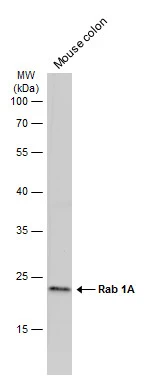 Mouse tissue extract (50 μg) was separated by 12% SDS-PAGE, and the membrane was blotted with Rab 1A antibody [N1C3] (GTX101454) diluted at 1:1000. The HRP-conjugated anti-rabbit IgG antibody (GTX213110-01) was used to detect the primary antibody, and the signal was developed with Trident ECL plus-Enhanced.