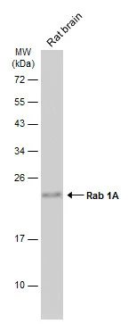Rat tissue extract (50 μg) was separated by 12% SDS-PAGE, and the membrane was blotted with Rab 1A antibody [N1C3] (GTX101454) diluted at 1:500. The HRP-conjugated anti-rabbit IgG antibody (GTX213110-01) was used to detect the primary antibody.