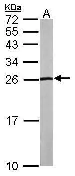 Sample (50 ug of whole cell lysate) A: mouse liver 15% SDS PAGE GTX101466 diluted at 1:1000