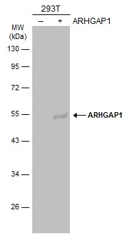 Non-transfected (–) and transfected (+) 293T whole cell extracts (30 μg) were separated by 10% SDS-PAGE, and the membrane was blotted with ARHGAP1 antibody [N3C3] (GTX101471) diluted at 1:5000. The HRP-conjugated anti-rabbit IgG antibody (GTX213110-01) was used to detect the primary antibody.