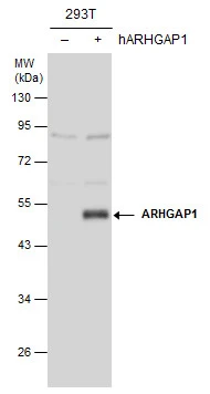 ARHGAP1 antibody detects ARHGAP1 protein by Western blot analysis. Non-transfected (-) and ARHGAP1-transfected (+) 293T whole cell extracts (30 μg) were separated by 10% SDS-PAGE, and the membrane was blotted with ARHGAP1 antibody (GTX101472) diluted at 1:1000.