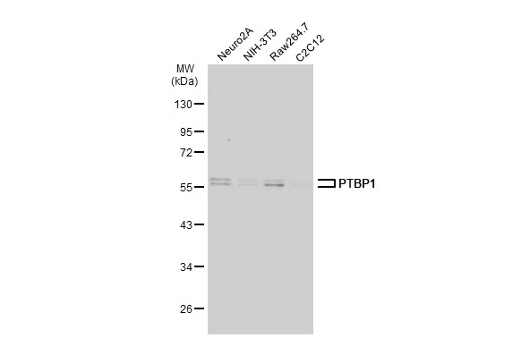 Various whole cell extracts (30 μg) were separated by 10% SDS-PAGE, and the membrane was blotted with PTBP1 antibody (GTX101481) diluted at 1:1000. The HRP-conjugated anti-rabbit IgG antibody (GTX213110-01) was used to detect the primary antibody.