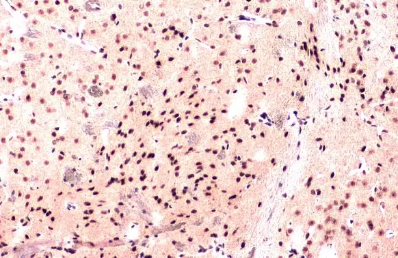 PTBP1 antibody detects PTBP1 protein at cytoplasm and nucleus by immunohistochemical analysis. Sample: Paraffin-embedded mouse brain. PTBP1 stained by PTBP1 antibody (GTX101481) diluted at 1:500. Antigen Retrieval: Citrate buffer, pH 6.0, 15 min