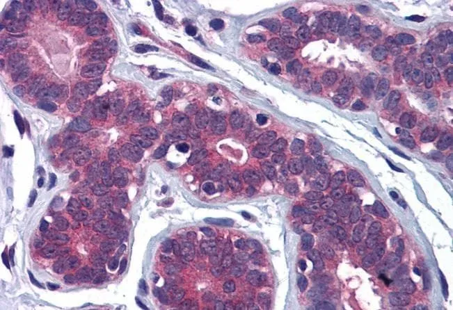 IHC-P analysis of human breast using GTX10149 MYRIP antibody, C-term. Antigen retrieval : citrate buffer pH 6 Dilution : 3.75microg/ml