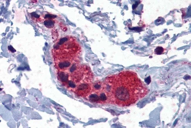 IHC-P analysis of human colon using GTX10149 MYRIP antibody, C-term. Antigen retrieval : citrate buffer pH 6 Dilution : 3.75microg/ml
