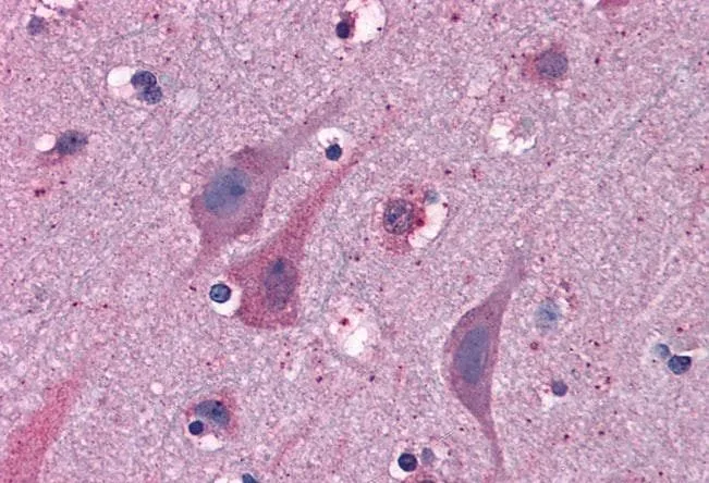 IHC-P analysis of human cortex using GTX10149 MYRIP antibody, C-term. Antigen retrieval : citrate buffer pH 6 Dilution : 3.75microg/ml