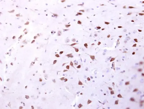 ENSA antibody detects ENSA protein at cytosol on mouse fore brain by immunohistochemical analysis. Sample: Paraffin-embedded mouse fore brain. ENSA antibody (GTX101493) dilution: 1:500. 
 Antigen Retrieval: Trilogy? (EDTA based, pH 8.0) buffer, 15min
