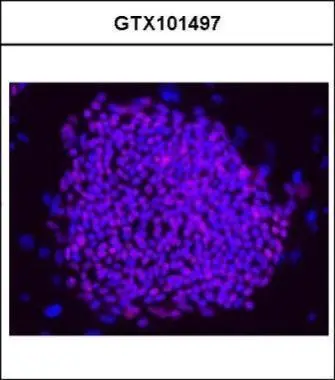 Immunofluorescence analysis of hESCs on CF1 feeders, using OCT3/4(GTX101497) antibody at 1:200 dilution.