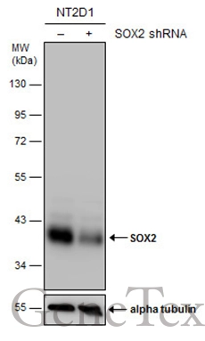 Non-transfected (–) and transfected (+) NT2D1 whole cell extracts (30 μg) were separated by 10% SDS-PAGE, and the membrane was blotted with SOX2 antibody [N1C3] (GTX101507) diluted at 1:15000. The HRP-conjugated anti-rabbit IgG antibody (GTX213110-01) was used to detect the primary antibody.