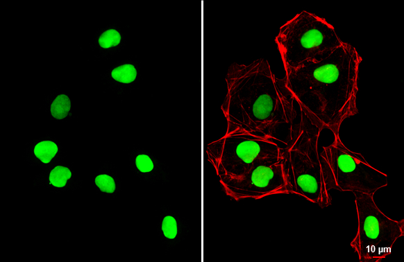 SOX2 antibody [N1C3] detects SOX2 protein at nucleus by immunofluorescent analysis. Sample: NT2D1 cells were fixed in 4% paraformaldehyde at RT for 15 min. Green: SOX2 stained by SOX2 antibody [N1C3] (GTX101507) diluted at 1:500. Red: phalloidin, a cytoskeleton marker, diluted at 1:100. Scale bar= 10 μm.