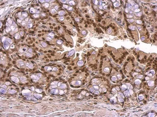 KLF4 antibody detects KLF4 protein at nucleus on mouse colon by immunohistochemical analysis. Sample: Paraffin-embedded mouse colon. KLF4 antibody (GTX101509) dilution: 1:500. 
 Antigen Retrieval: Trilogy? (EDTA based, pH 8.0) buffer, 15min