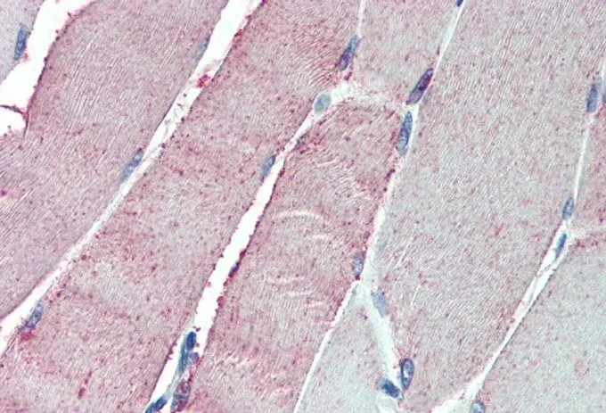 WB analysis of human muscle lysate using GTX10151 ORP1 antibody,C-term. Dilution : 0.5ug/ml Loading : 35ug protein in RIPA buffer