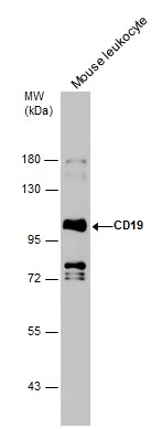 Mouse tissue extract (50 μg) was separated by 7.5% SDS-PAGE, and the membrane was blotted with CD19 antibody [C1C3] (GTX101512) diluted at 1:1000.