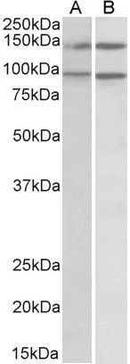 WB analysis of Daudi (A) and Caco-2 (B) cell lysate using GTX10152 ARHGEF18 antibody,C-term. Dilution : 0.5ug/ml Loading : 35ug protein in RIPA buffer