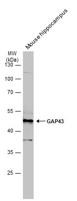 Mouse tissue extract (50 μg) was separated by 10% SDS-PAGE, and the membrane was blotted with GAP43 antibody (GTX101535) diluted at 1:1000. The HRP-conjugated anti-rabbit IgG antibody (GTX213110-01) was used to detect the primary antibody.
