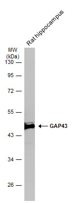 Rat tissue extract (50 μg) was separated by 10% SDS-PAGE, and the membrane was blotted with GAP43 antibody (GTX101535) diluted at 1:1000. The HRP-conjugated anti-rabbit IgG antibody (GTX213110-01) was used to detect the primary antibody.