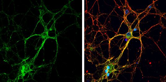 GAP43 antibody detects GAP43 protein by immunofluorescent analysis. Sample: DIV9 rat E18 primary cortical neurons were fixed in 4% paraformaldehyde at RT for 15 min. Green: GAP43 protein stained by GAP43 antibody (GTX101535) diluted at 1:500. Red: beta Tubulin 3/ Tuj1, stained by beta Tubulin 3/ Tuj1 antibody [GT886] (GTX631830) diluted at 1:500. Blue: Fluoroshield with DAPI (GTX30920).