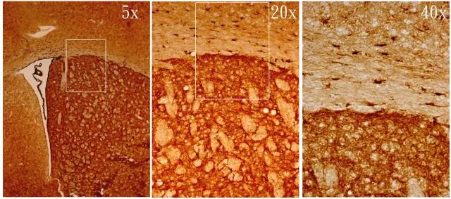 MSI1 antibody [N3C3] detects MSI1 protein on adult mouse brain by immunohistochemical analysis. Sample: Frozen section of adult mouse brain. MSI1 antibody [N3C3] (GTX101540) diluted at 1:500.