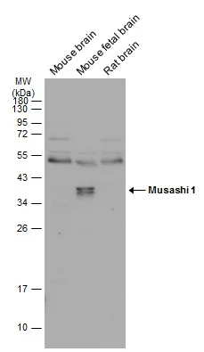 Various tissue extracts (50 μg) were separated by 12% SDS-PAGE, and the membrane was blotted with Musashi 1 antibody [N3C3] (GTX101540) diluted at 1:1000. The HRP-conjugated anti-rabbit IgG antibody (GTX213110-01) was used to detect the primary antibody.