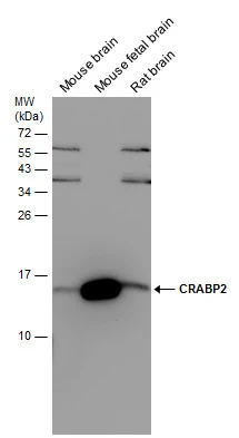 Various tissue extracts (50 μg) were separated by 15% SDS-PAGE, and the membrane was blotted with CRABP2 antibody [N1C3] (GTX101551) diluted at 1:1000.