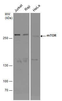 mTOR antibody detects mTOR protein by western blot analysis. Various whole cell extracts (30 μg) were separated by 5% SDS-PAGE, and the membrane was blotted with mTOR antibody (GTX101558) diluted at a dilution of 1:1000.