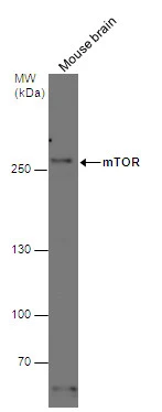 mTOR antibody [C1], Internal detects mTOR protein by western blot analysis. Mouse tissue extracts (50 μg) was separated by 5% SDS-PAGE, and the membrane was blotted with mTOR antibody [C1], Internal (GTX101558) diluted at 1:500.