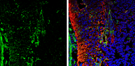 Galectin 1 antibody detects Galectin 1 protein expression by immunohistochemical analysis. Sample: Frozen sectioned E13.5 Rat brain. Green: Galectin 1 protein stained by Galectin 1 antibody (GTX101566) diluted at 1:250. Red: beta Tubulin 3/ TUJ1, a mature neuron marker, stained by beta Tubulin 3/ TUJ1 antibody [GT11710] (GTX631836) diluted at 1:500. Blue: Fluoroshield with DAPI (GTX30920).