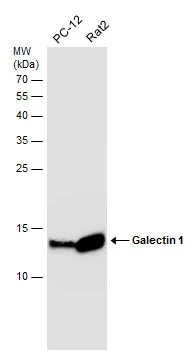 Various whole cell extracts (30 μg) were separated by 15% SDS-PAGE, and the membrane was blotted with Galectin 1 antibody (GTX101566) diluted at 1:10000. The HRP-conjugated anti-rabbit IgG antibody (GTX213110-01) was used to detect the primary antibody.