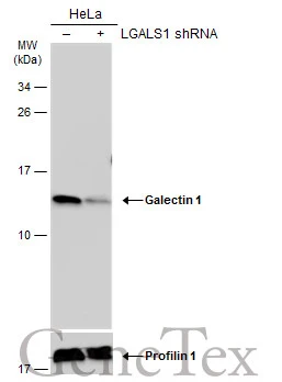 Non-transfected (–) and transfected (+) HeLa whole cell extracts (30 μg) were separated by 15% SDS-PAGE, and the membrane was blotted with Galectin 1 antibody (GTX101566) diluted at 1:10000. The HRP-conjugated anti-rabbit IgG antibody (GTX213110-01) was used to detect the primary antibody.