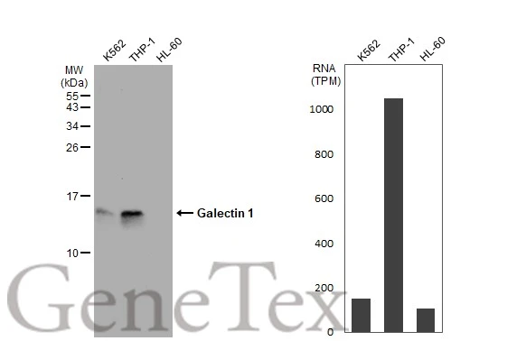 Non-transfected (�) and transfected (+) HeLa whole cell extracts (30 ug) were separated by 15% SDS-PAGE,and the membrane was blotted with Galectin 1 antibody (GTX101566) diluted at 1:10000.