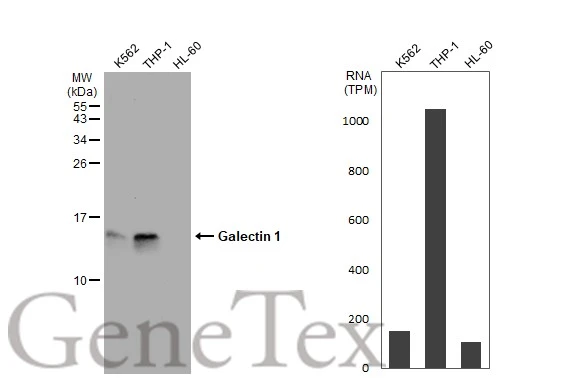 Various whole cell extracts (30 μg) were separated by 15% SDS-PAGE, and the membrane was blotted with Galectin 1 antibody (GTX101566) diluted at 1:2000. The HRP-conjugated anti-rabbit IgG antibody (GTX213110-01) was used to detect the primary antibody. Corresponding RNA expression data for the same cell lines are based on Human Protein Atlas program.