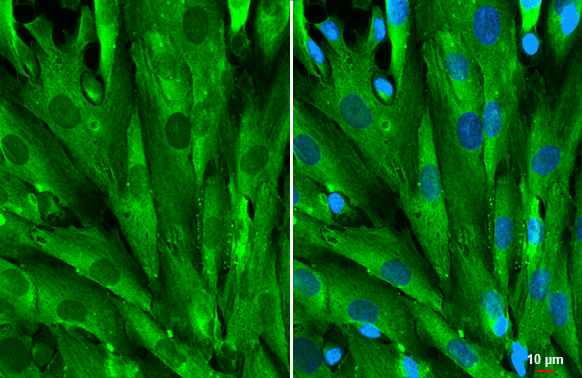 Galectin 1 antibody detects Galectin 1 protein at cytoplasm by immunofluorescent analysis. Sample: SK-N-SH cells were fixed in 4% paraformaldehyde at RT for 15 min. Green: Galectin 1 stained by Galectin 1 antibody (GTX101566) diluted at 1:1000. Blue: Fluoroshield with DAPI (GTX30920). Scale bar= 10 μm.