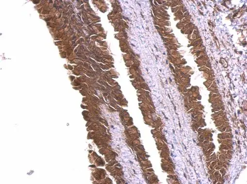alpha Adducin antibody detects alpha Adducin protein at membrane and cytosol on mouse esophagus by immunohistochemical analysis. Sample: Paraffin-embedded mouse esophagus. alpha Adducin antibody (GTX101574) dilution: 1:500.
Antigen Retrieval: Trilogy? (EDTA based, pH 8.0) buffer, 15min alpha Adducin antibody detects alpha Adducin protein at membrane and cytosol on mouse esophagus by immunohistochemical analysis. Sample: Paraffin-embedded mouse esophagus. alpha Adducin antibody (GTX101574) dilution: 1:500.
Antigen Retrieval: Trilogy? (EDTA based, pH 8.0) buffer, 15min