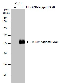 Non-transfected (–) and transfected (+) 293T whole cell extracts (30 μg) were separated by 10% SDS-PAGE, and the membrane was blotted with PAX8 antibody (GTX101583) diluted at 1:10000. The HRP-conjugated anti-rabbit IgG antibody (GTX213110-01) was used to detect the primary antibody. Non-transfected (–) and transfected (+) 293T whole cell extracts (30 μg) were separated by 10% SDS-PAGE, and the membrane was blotted with PAX8 antibody (GTX101583) diluted at 1:10000. The HRP-conjugated anti-rabbit IgG antibody (GTX213110-01) was used to detect the primary antibody.