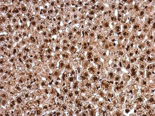 PAX8 antibody detects PAX8 protein at nucleus in mouse liver by immunohistochemical analysis. Sample: Paraffin-embedded mouse liver. PAX8 antibody (GTX101583) diluted at 1:500.
Antigen Retrieval: Citrate buffer, pH 6.0, 15 min PAX8 antibody detects PAX8 protein at nucleus in mouse liver by immunohistochemical analysis. Sample: Paraffin-embedded mouse liver. PAX8 antibody (GTX101583) diluted at 1:500.
Antigen Retrieval: Citrate buffer, pH 6.0, 15 min