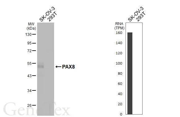 Anti-PAX8 antibody (GTX101583) | GeneTex