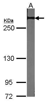 Sample (30 ug of whole cell lysate) A:NIH-3T3 5% SDS PAGE GTX101593 diluted at 1:1000 The HRP-conjugated anti-rabbit IgG antibody (GTX213110-01) was used to detect the primary antibody.