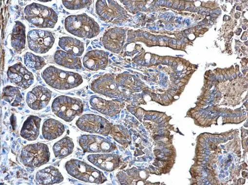 alpha Adducin antibody detects alpha Adducin protein at membrane on mouse intestine by immunohistochemical analysis. Sample: Paraffin-embedded mouse intestine. alpha Adducin antibody (GTX101600) dilution: 1:500. 
 Antigen Retrieval: Trilogy? (EDTA based, pH 8.0) buffer, 15min