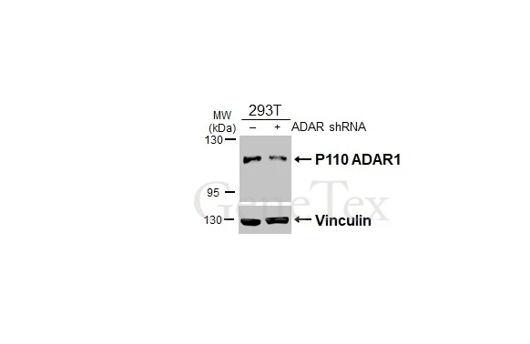 Non-transfected (–) and transfected (+) 293T whole cell extracts (30 μg) were separated by 5% SDS-PAGE, and the membrane was blotted with ADAR1 antibody [N3C1], Internal (GTX101602) diluted at 1:3000. The HRP-conjugated anti-rabbit IgG antibody (GTX213110-01) was used to detect the primary antibody.