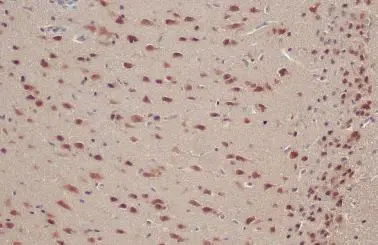 ADAR1 antibody [N3C1], Internal detects ADAR1 protein at cytoplasm and nucleus by immunohistochemical analysis. Sample: Paraffin-embedded rat brain. ADAR1 stained by ADAR1 antibody [N3C1], Internal (GTX101602) diluted at 1:500. Antigen Retrieval: Citrate buffer, pH 6.0, 15 min